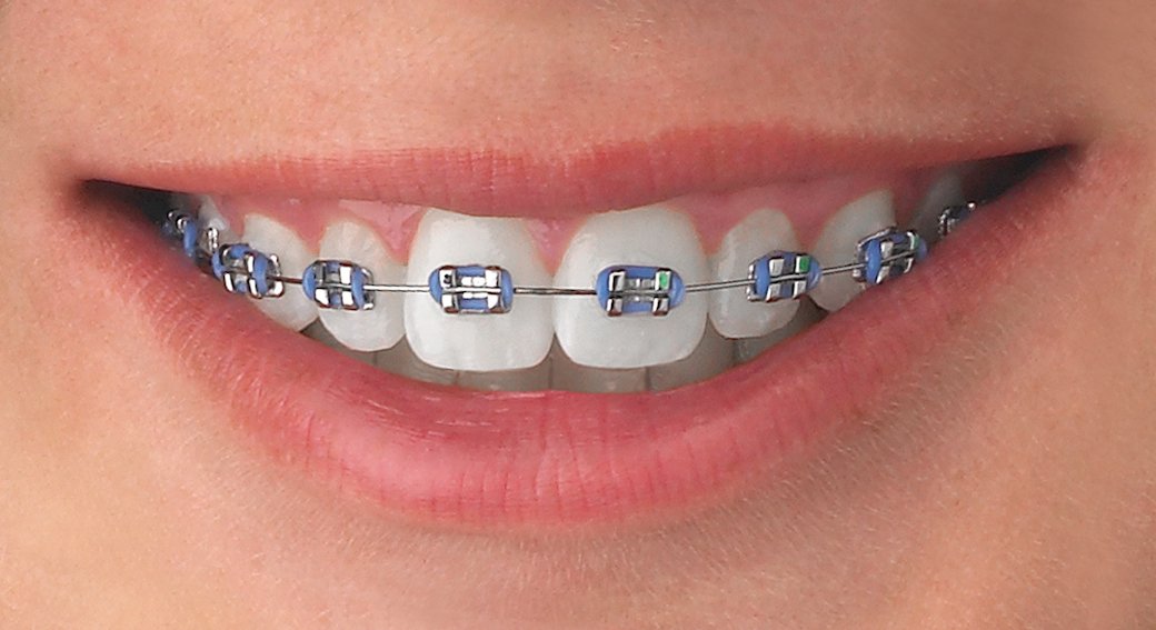 https://dentalarcada.mx/wp-content/uploads/2025/02/que_es_una_ortodoncia.jpg